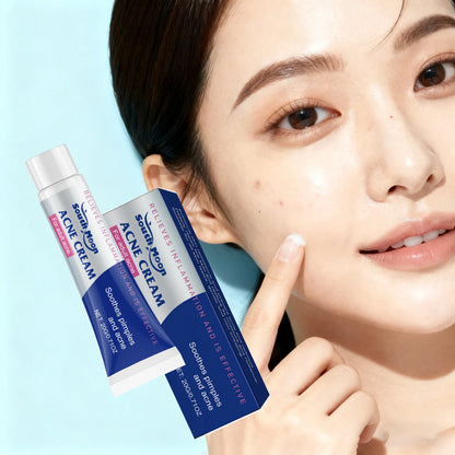 Anti Acne Cream Oil Control Repair Pimple Spot Remove Acne Mark Cleaning