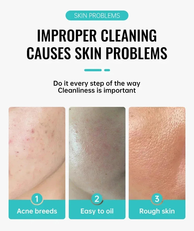 Anti-Acne Repair Redness Pimple Spots Deep Cleaning Pore Oil Control Moisturizing Skin Care