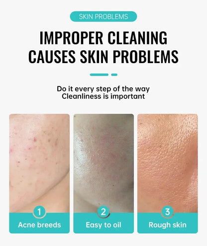 Anti-Acne Repair Redness Pimple Spots Deep Cleaning Pore Oil Control Moisturizing Skin Care