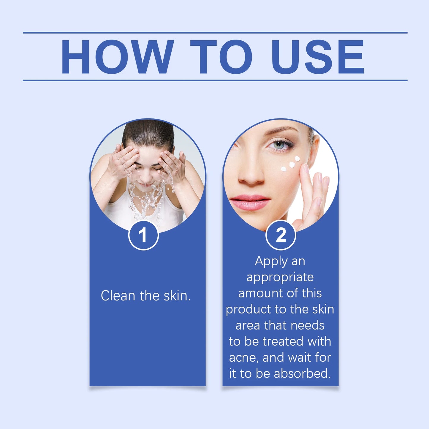 Anti Acne Cream Oil Control Repair Pimple Spot Remove