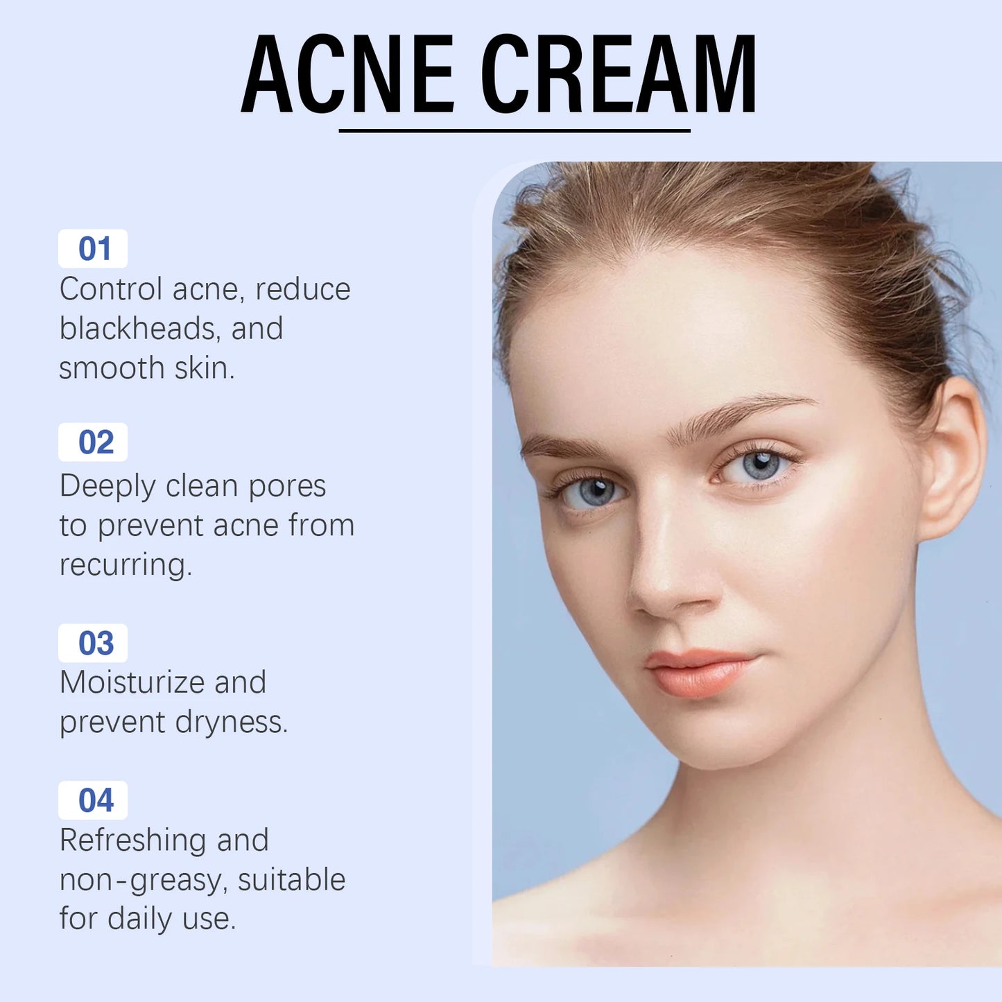 Anti Acne Cream Oil Control Repair Pimple Spot Remove