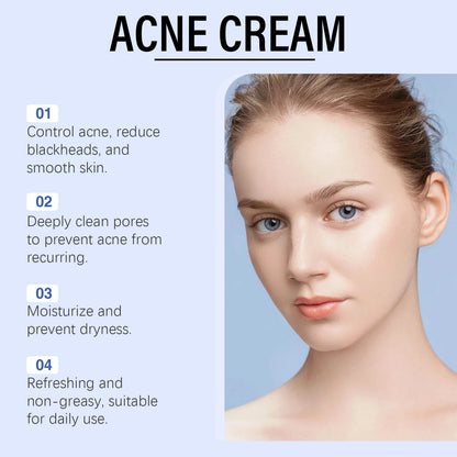 Anti Acne Cream Oil Control Repair Pimple Spot Remove
